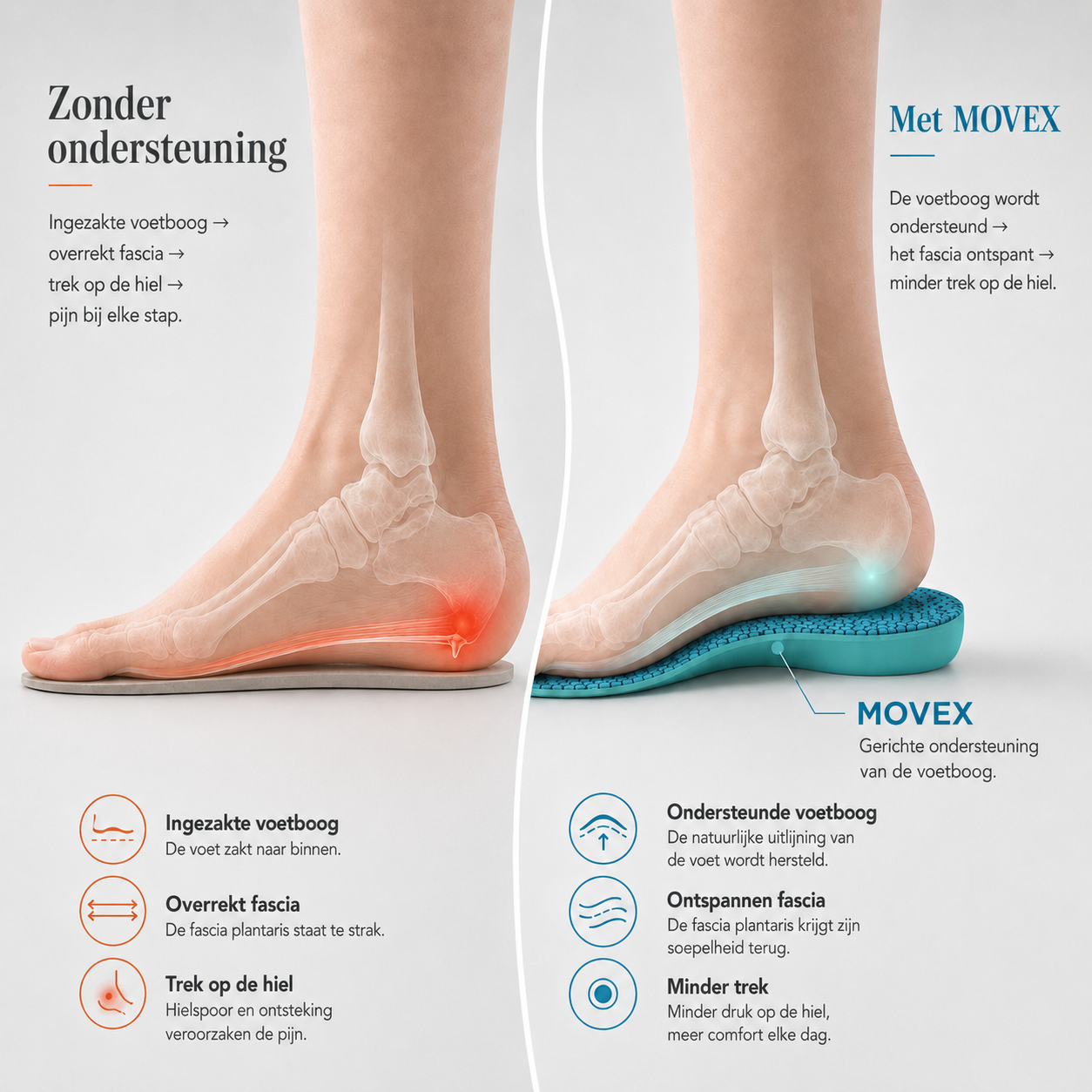 MOVEX™ Comfort Inlegzolen